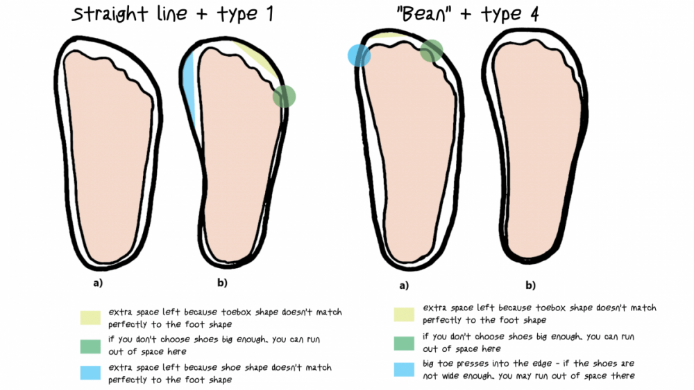 What is my Foot Type? Bose Nogice